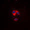 Neutrophil Cytosolic Factor 1 antibody, LS-C356207, Lifespan Biosciences, Immunofluorescence image 