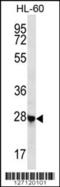 RBPJ Interacting And Tubulin Associated 1 antibody, 56-417, ProSci, Western Blot image 