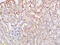 Interleukin 1 Receptor Like 1 antibody, GTX60302, GeneTex, Immunohistochemistry paraffin image 