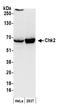 Checkpoint Kinase 2 antibody, A300-618A, Bethyl Labs, Western Blot image 