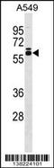 Dihydrouridine Synthase 2 antibody, 59-760, ProSci, Western Blot image 