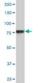 Ribosomal Protein S6 Kinase A6 antibody, H00027330-M02, Novus Biologicals, Western Blot image 