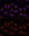 Protein Phosphatase 2 Catalytic Subunit Beta antibody, GTX33421, GeneTex, Immunofluorescence image 