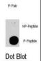 TSC Complex Subunit 2 antibody, abx031975, Abbexa, Immunocytochemistry image 