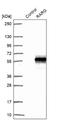 Retinoic Acid Receptor Gamma antibody, NBP2-47314, Novus Biologicals, Western Blot image 