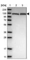 116 kDa U5 small nuclear ribonucleoprotein component antibody, NBP1-87019, Novus Biologicals, Western Blot image 