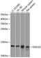 G Protein Subunit Gamma 10 antibody, A13187, Boster Biological Technology, Western Blot image 