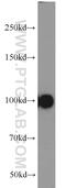 Inter-Alpha-Trypsin Inhibitor Heavy Chain 3 antibody, 21247-1-AP, Proteintech Group, Western Blot image 