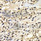 Zinc Finger Protein 169 antibody, A7486, ABclonal Technology, Immunohistochemistry paraffin image 