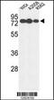 Glucuronidase Beta antibody, MBS9209223, MyBioSource, Western Blot image 