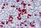 Cadherin 18 antibody, MBS245968, MyBioSource, Immunohistochemistry paraffin image 