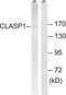 Cytoplasmic Linker Associated Protein 1 antibody, A30619, Boster Biological Technology, Western Blot image 