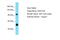 Vir Like M6A Methyltransferase Associated antibody, ARP70670_P050, Aviva Systems Biology, Western Blot image 