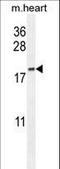 Outer Dense Fiber Of Sperm Tails 3B antibody, LS-C163107, Lifespan Biosciences, Western Blot image 