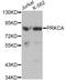 Protein Kinase C Alpha antibody, A0267, ABclonal Technology, Western Blot image 