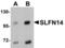 Schlafen Family Member 14 antibody, TA306895, Origene, Western Blot image 