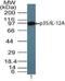 Interleukin 12A antibody, NBP2-24627, Novus Biologicals, Western Blot image 