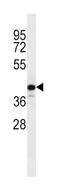 C9orf72-SMCR8 Complex Subunit antibody, abx027096, Abbexa, Western Blot image 