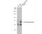 Interleukin 13 Receptor Subunit Alpha 1 antibody, NBP2-16942, Novus Biologicals, Western Blot image 