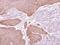 Epoxide Hydrolase 1 antibody, PA5-22082, Invitrogen Antibodies, Immunohistochemistry paraffin image 