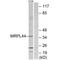 Mitochondrial Ribosomal Protein L44 antibody, A10898, Boster Biological Technology, Western Blot image 