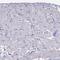 Troponin T3, Fast Skeletal Type antibody, PA5-58115, Invitrogen Antibodies, Immunohistochemistry frozen image 