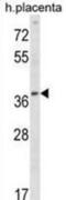 Ubiquitin-conjugating enzyme E2 Q2 antibody, abx029002, Abbexa, Western Blot image 