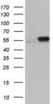 Pyruvate Kinase M1/2 antibody, LS-C337113, Lifespan Biosciences, Western Blot image 