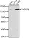 TNF Receptor Superfamily Member 8 antibody, GTX55557, GeneTex, Western Blot image 