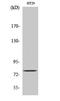 EPS8 Like 1 antibody, STJ92963, St John