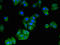 Methionine Adenosyltransferase 2B antibody, orb52158, Biorbyt, Immunocytochemistry image 
