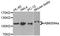 ADAM Metallopeptidase With Thrombospondin Type 1 Motif 5 antibody, abx007374, Abbexa, Western Blot image 