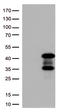 Protein Kinase AMP-Activated Non-Catalytic Subunit Beta 1 antibody, LS-C793200, Lifespan Biosciences, Western Blot image 