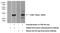 Human Chorionic gonadotrophin antibody, 11615-1-AP, Proteintech Group, Western Blot image 
