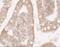 Ring Finger And CCCH-Type Domains 1 antibody, A06498, Boster Biological Technology, Immunohistochemistry frozen image 