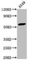 Interferon Induced Protein With Tetratricopeptide Repeats 3 antibody, CSB-PA011022HA01HU, Cusabio, Western Blot image 