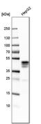 Asialoglycoprotein Receptor 1 antibody, HPA011954, Atlas Antibodies, Western Blot image 