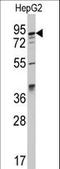 AP2 Associated Kinase 1 antibody, LS-C97469, Lifespan Biosciences, Western Blot image 