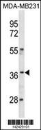 Homeobox C10 antibody, 60-864, ProSci, Western Blot image 