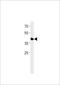 Transcription Factor AP-2 Epsilon antibody, LS-C204012, Lifespan Biosciences, Western Blot image 