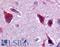 Ceramide kinase antibody, LS-A4556, Lifespan Biosciences, Immunohistochemistry frozen image 