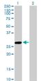 Kynurenine Aminotransferase 1 antibody, H00000883-M02, Novus Biologicals, Western Blot image 