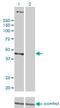 Proteasome 26S Subunit, Non-ATPase 6 antibody, H00009861-M01, Novus Biologicals, Western Blot image 