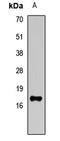 Ubiquitin Conjugating Enzyme E2 A antibody, LS-C668180, Lifespan Biosciences, Western Blot image 