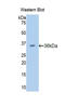 Proprotein Convertase Subtilisin/Kexin Type 9 antibody, LS-C373240, Lifespan Biosciences, Western Blot image 