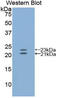 Endothelin 1 antibody, LS-C293754, Lifespan Biosciences, Western Blot image 