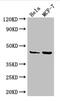 Mitogen-Activated Protein Kinase Kinase 4 antibody, CSB-PA013413LA01HU, Cusabio, Western Blot image 