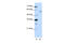 Zinc Finger Protein 497 antibody, 29-183, ProSci, Western Blot image 