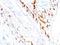 CD1a Molecule antibody, M00375, Boster Biological Technology, Immunohistochemistry paraffin image 