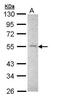 Matrix Metallopeptidase 16 antibody, PA5-28966, Invitrogen Antibodies, Western Blot image 